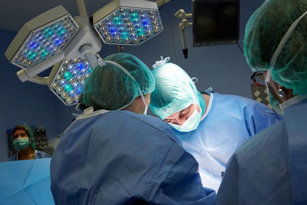 Chronic prostatitis operation