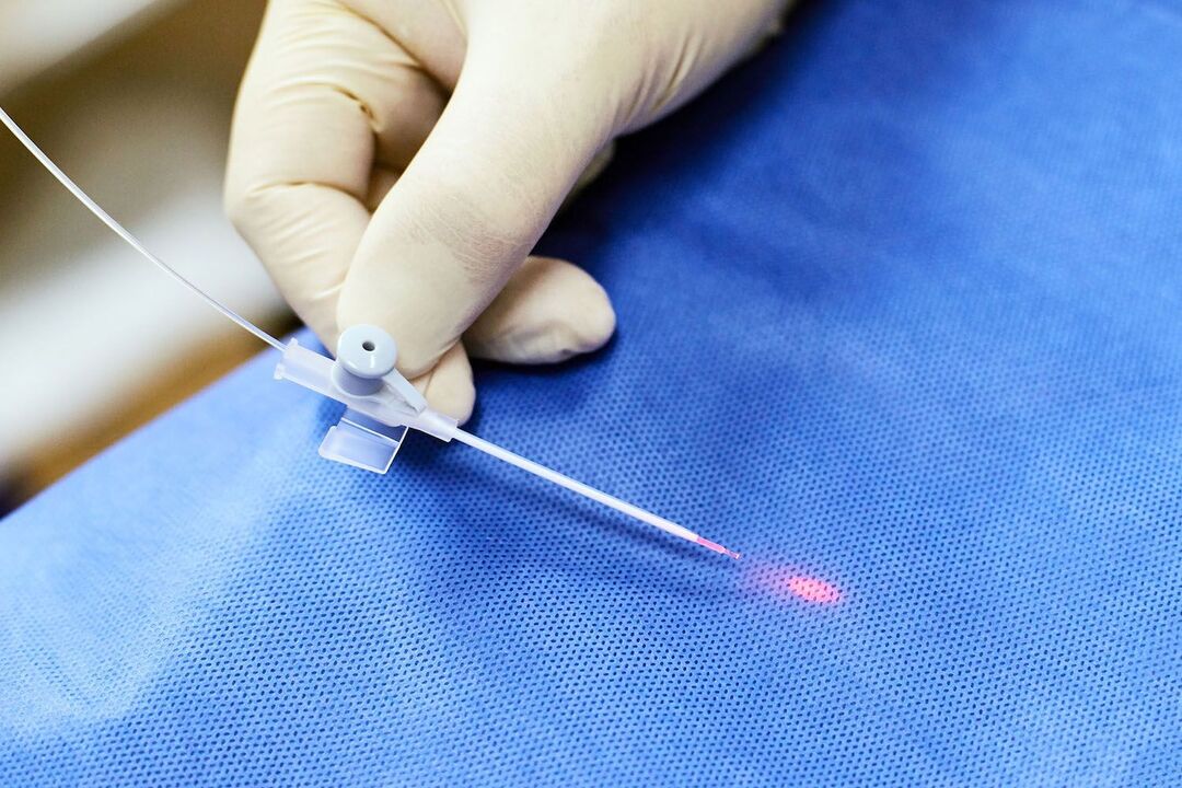transrectal device for prostate treatment